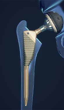 Medical Industry